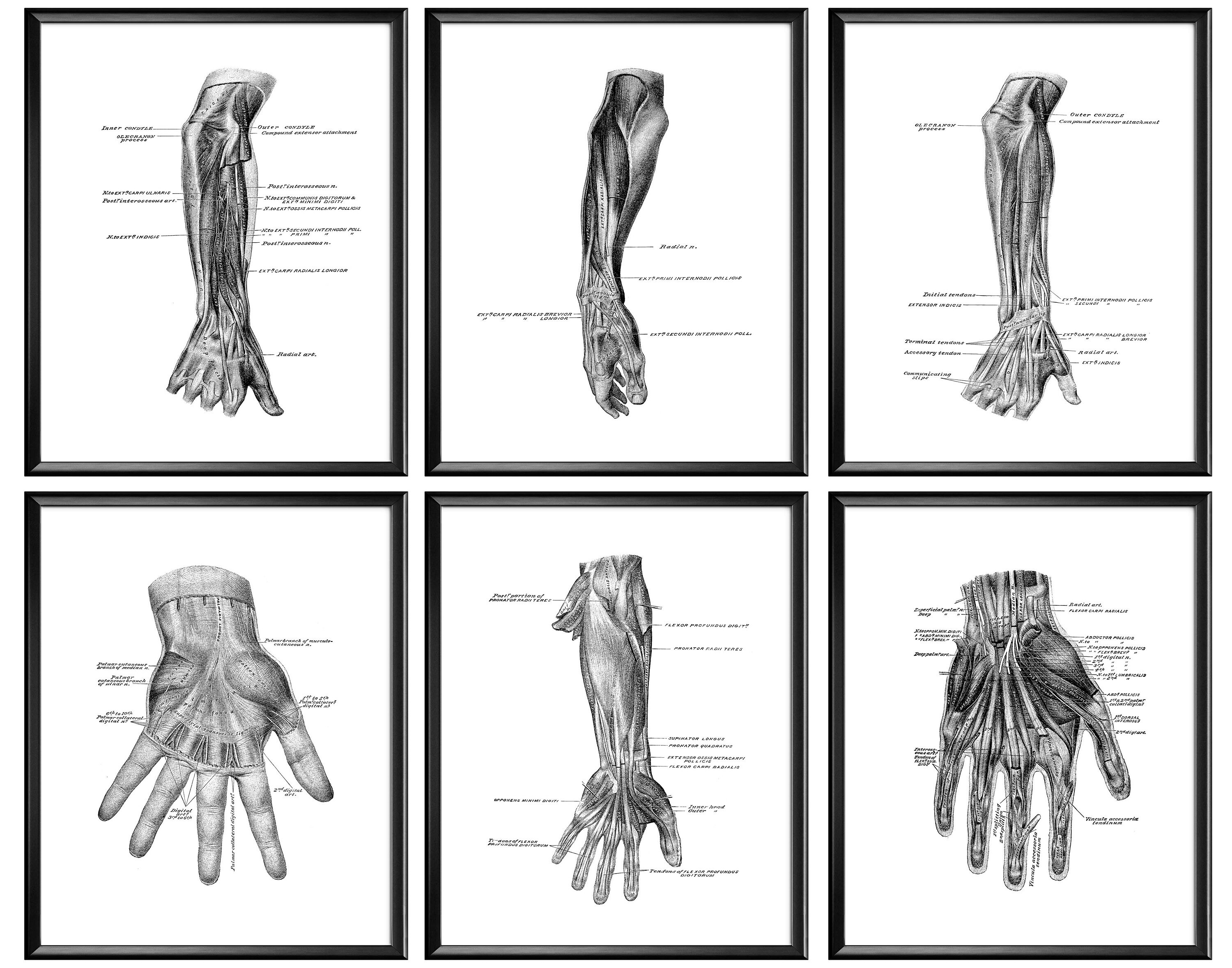 Set 6 Hand Anatomy Posters Wrist Diagram Hand Structure Print Medical