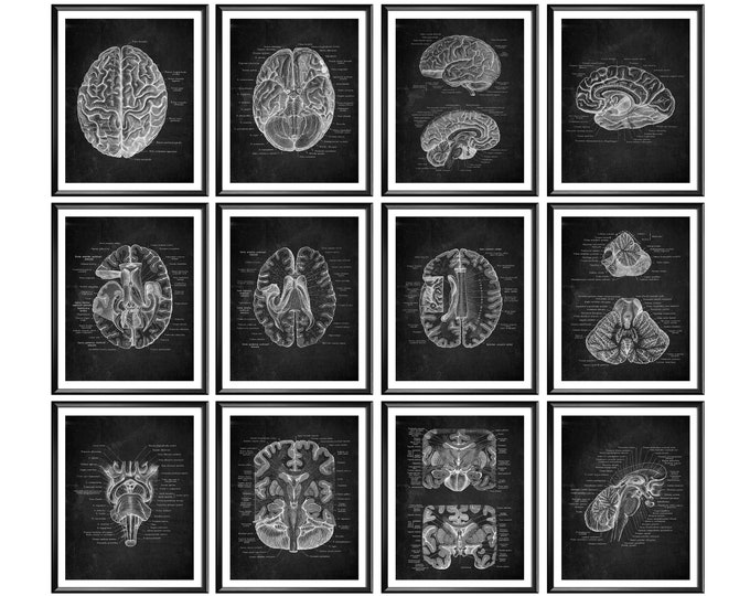3 Brain Anatomy Art, Neurology Art, Medical Art, Gold Foil Art ...