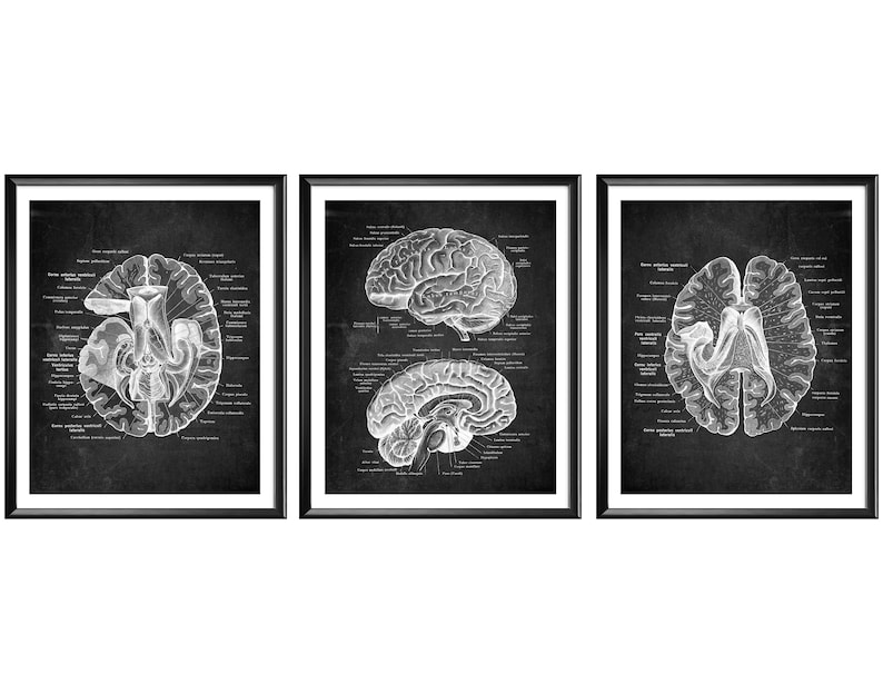 Anatomical Brain Poster Neurology Chalkboard Art Human Brain | Etsy