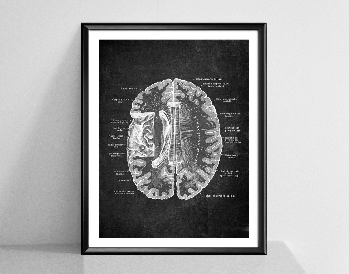 Neurology Chalkboard Art Anatomical Brain Poster Human Brain Structure ...