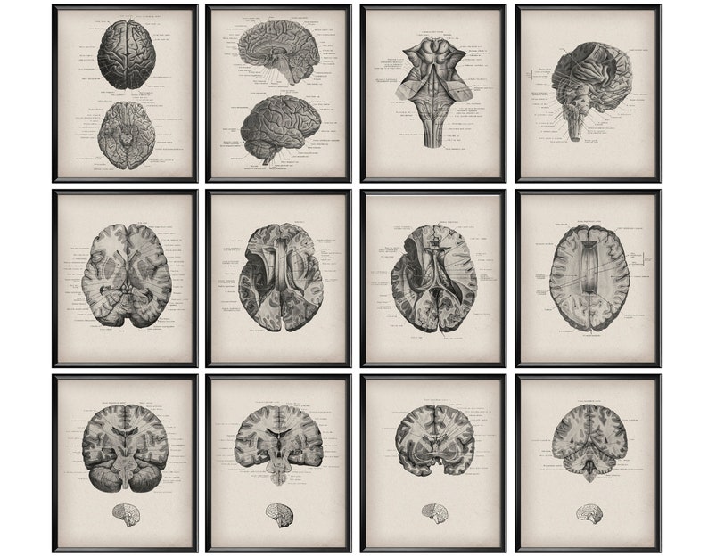 12 Anatomical Brain Vintage Anatomy Poster Neurology Art Neurosurgeon ...