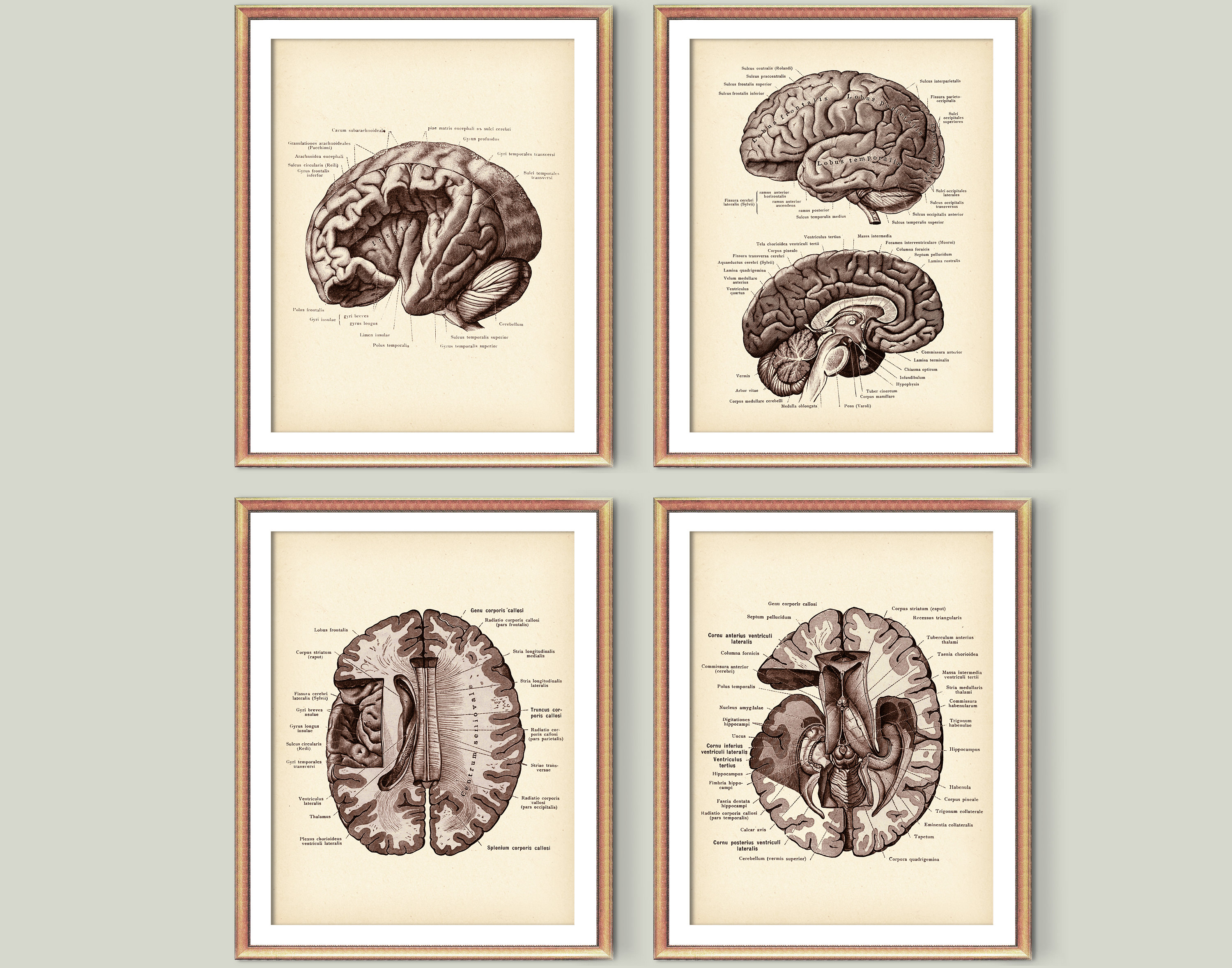 Medical Gross Anatomy Vintage Anatomical Brain Dissection Dictionary Art Print 