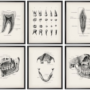 Juego de 6 carteles de arte de anatomía dental vintage, regalo de dentista, decoración de consultorio dental, regalo de ortodoncista, decoración de clínica dental, regalo de asistente dental
