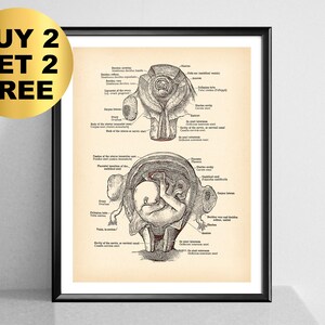 Fetus in Womb Vintage Poster Fetal Development Print Female Reproductive System Uterus Print Gynecology Art Midwife Gift Gynecologist Decor