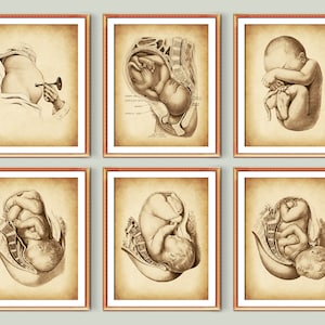 6 Vintage embarazo y parto arte obstetricia arte cuidado del embarazo arte abdomen embarazada cartel feto en el útero dibujo partería decoración