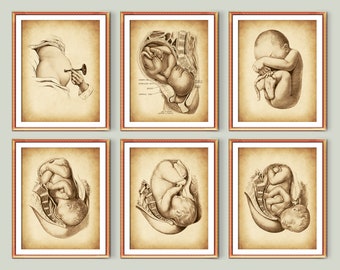 Puede incluir: Conjunto de seis grabados enmarcados de estilo vintage que representan las etapas del desarrollo fetal. Las ilustraciones en tonos sepia muestran detalles anatómicos del feto en el útero y un examen médico. Los marcos tienen un borde marrón.