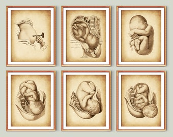 6 Vintage Pregnancy and Childbirth Art Obstetrics Art Pregnancy Care Art Pregnant Abdoment Poster Fetus in Utero Drawing Midwifery Decor