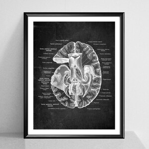 Neurology Chalkboard Art Anatomical Brain Poster Human Brain Structure ...