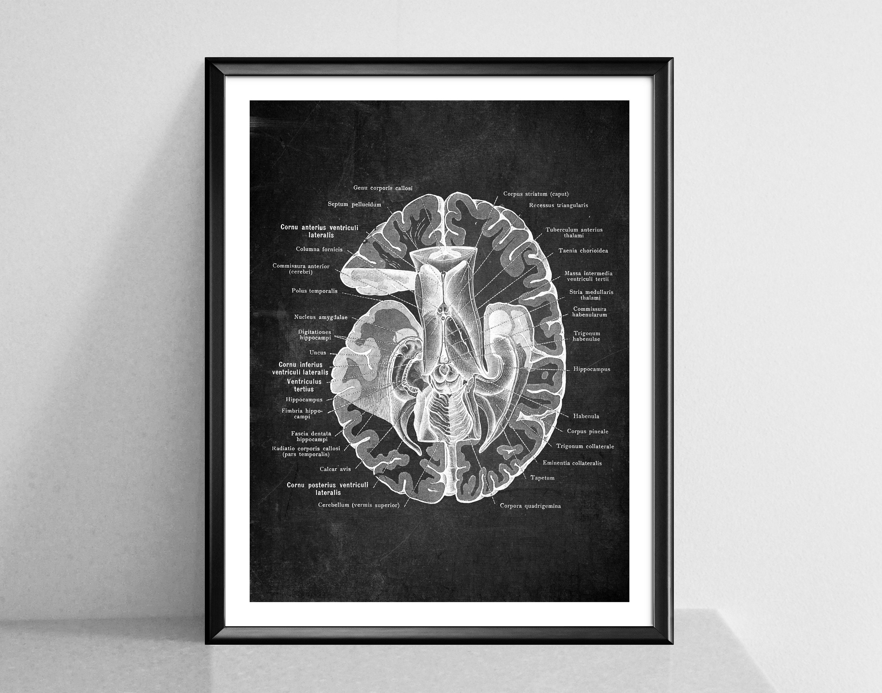 Neurology Chalkboard Art Anatomical Brain Poster Human Brain Structure ...
