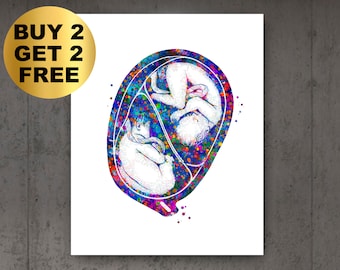 Tweeling foetus in baarmoeder Kunstwerk Zwangerschap Art Obgyn Kunst Gynaecologie Kunst Zwangere Vrouw Gift Baby Douche Decor Verloskundige Gift Doctor Office Art