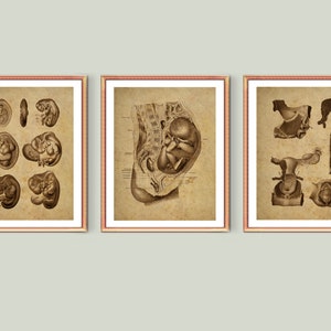 Obgyn Vintage Posters Fetus in Womb Ilustración antigua Desarrollo embrionario Embarazo Arte médico Matrona Arte femenino Anatomía femenina Arte