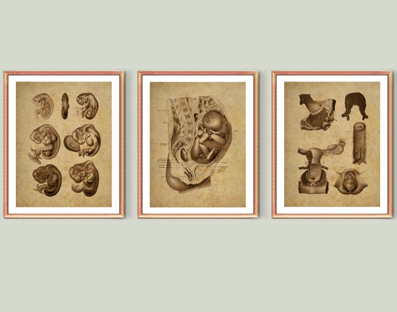 Obgyn Vintage Posters Fetus in Womb Antique Illustration | Etsy