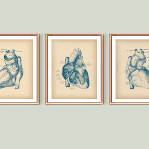 3 Vintage Anatomie Kunst Anatomisches Herz Kunst Kardiologie Kunst Medizinische Kunst Herz Chirurg Geschenk Klinik Dekor Arzt Büro Kunst Krankenschwester Geschenk