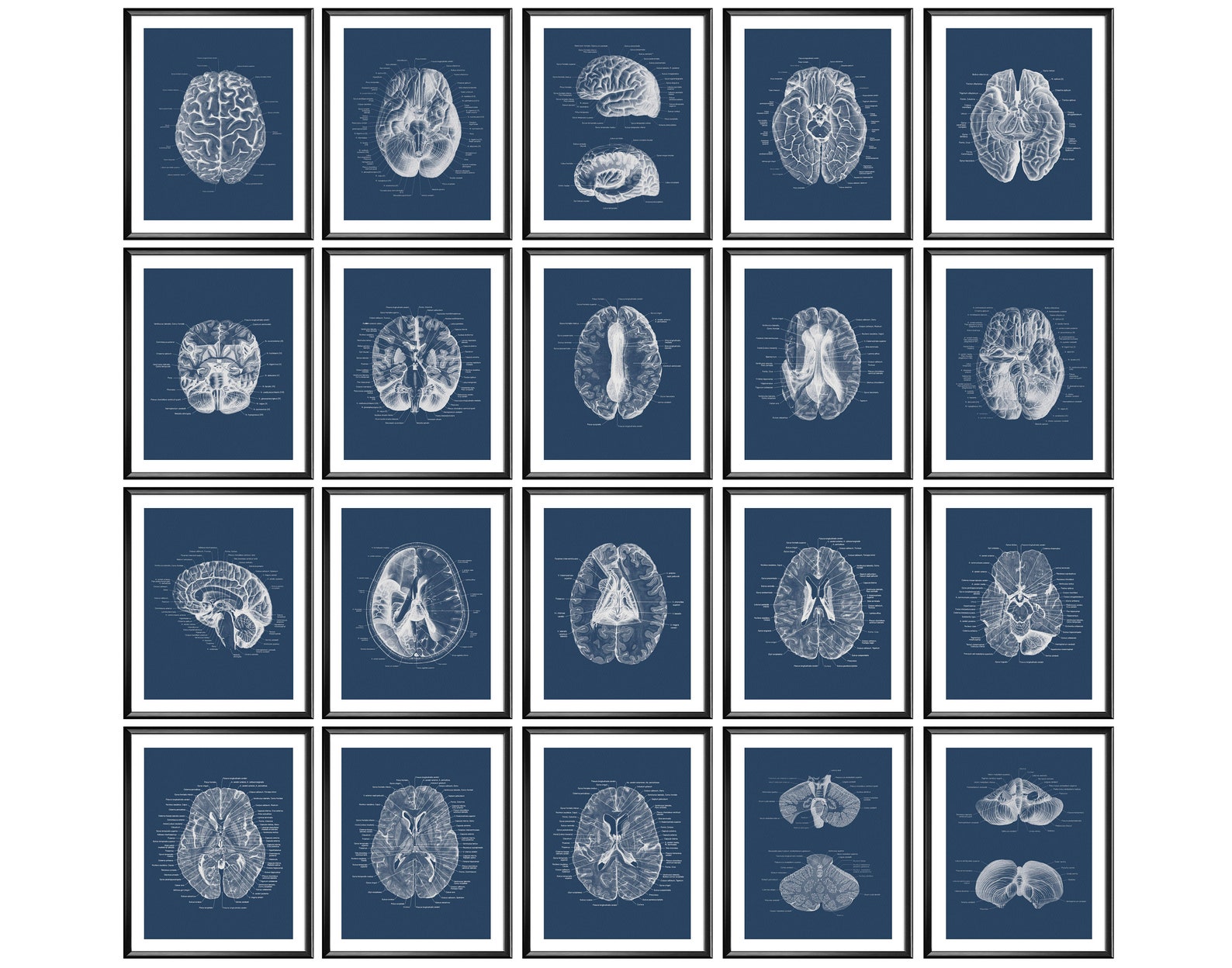 20 Neurology Art Brain Anatomy Art Cross Section Diagram Medical Decor ...