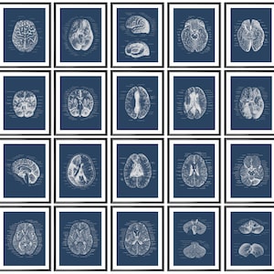 May include: A set of 20 printable vintage anatomical brain illustrations in a blue colour scheme. The illustrations are in black and white and feature different views of the human brain.