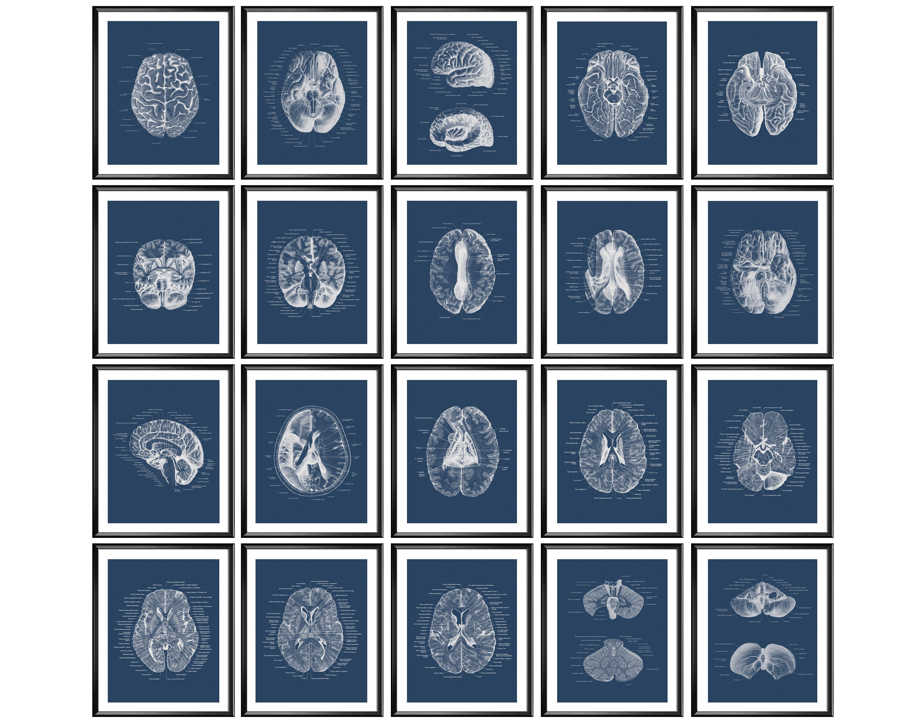 20 Neurology Art Brain Anatomy Art Cross Section Diagram Medical Decor ...