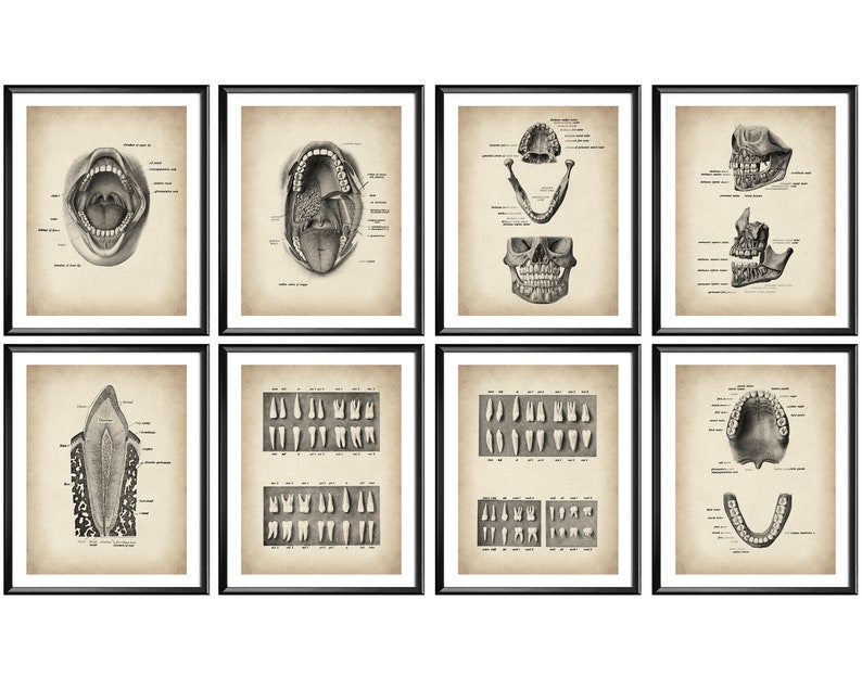 8 Antique Dental Posters, Medical Art, Dentist Gift, Orthodontist Gift ...