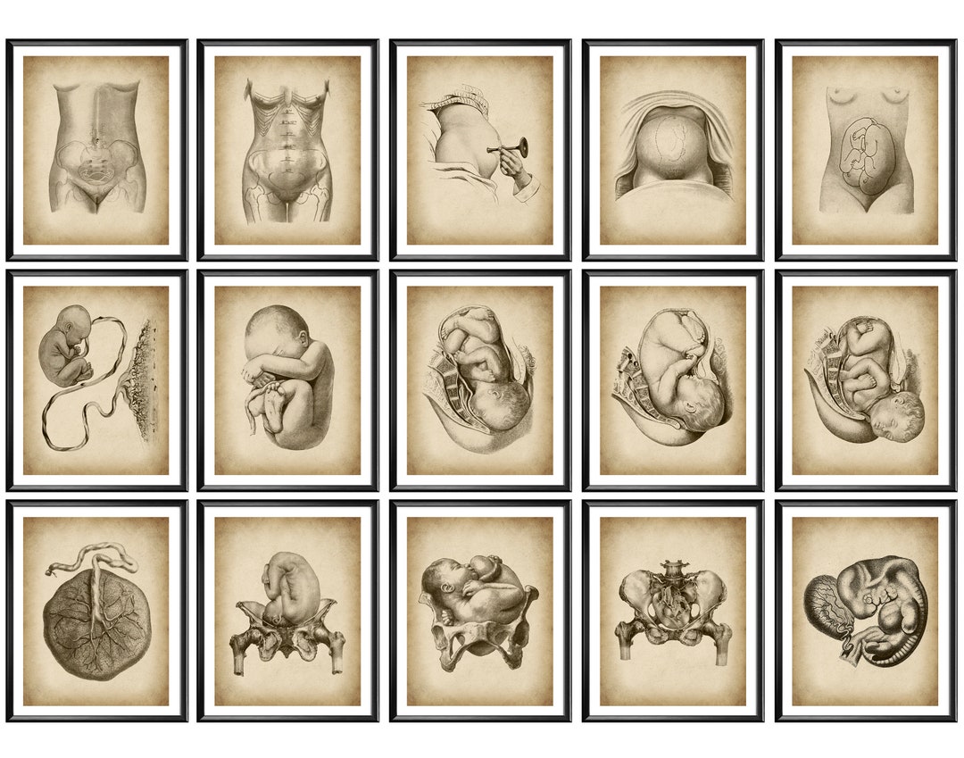 15 Vintage Pregnancy and Obstetrics Posters Obgyn Artwork Childbirth ...