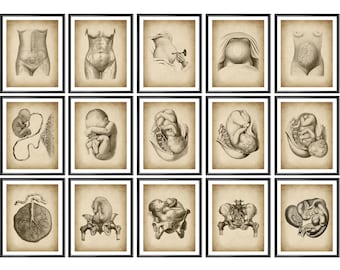 15 Vintage Pregnancy and Obstetrics Posters Obgyn Artwork Childbirth Art Fetal Development Diagram Midwife Gift Obstetrician Gift Gynecology