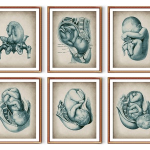 Set 6 Vintage Geburt Poster Anatomie Kunst Schwangerschaft Kunst Medizinische Kunst Hebamme Geschenk Obgyn Kunst Geburtshilfe Kunst Gynäkologie Kunst Schwanger Geschenk