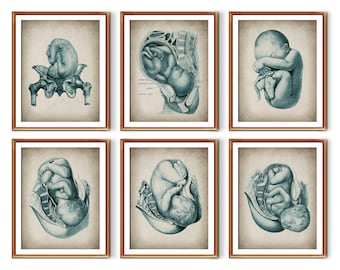 Set 6 of Vintage Childbirth Posters Anatomy Art Pregnancy Art Medical Art Midwife Gift Obgyn Art Obstetrics Art Gynecology Art Pregnant Gift