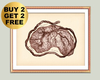 Placenta Vintage Art, Umbilical Cord Anatomy, Medical Art, Pregnancy Art, Antique Anatomy Poster, Fetal Development