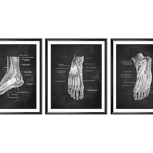 Foot Poster Bones and Muscles Anatomy Chalkboard Art Podiatry Art Medical Art Orthopedic Office Gift Chiropractor Gift Clinic Wall Decor