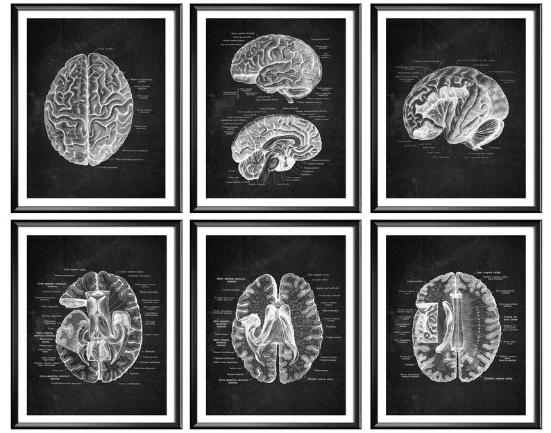 6 Anatomical Brain Posters Neurology Art Medical Art Anatomy Art ...
