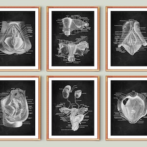 Female Anatomy Chalkboard Art Reproductive System Poster Anatomical Uterus Gynecologist Gift Physiology Education Chart Doctor Office Decor