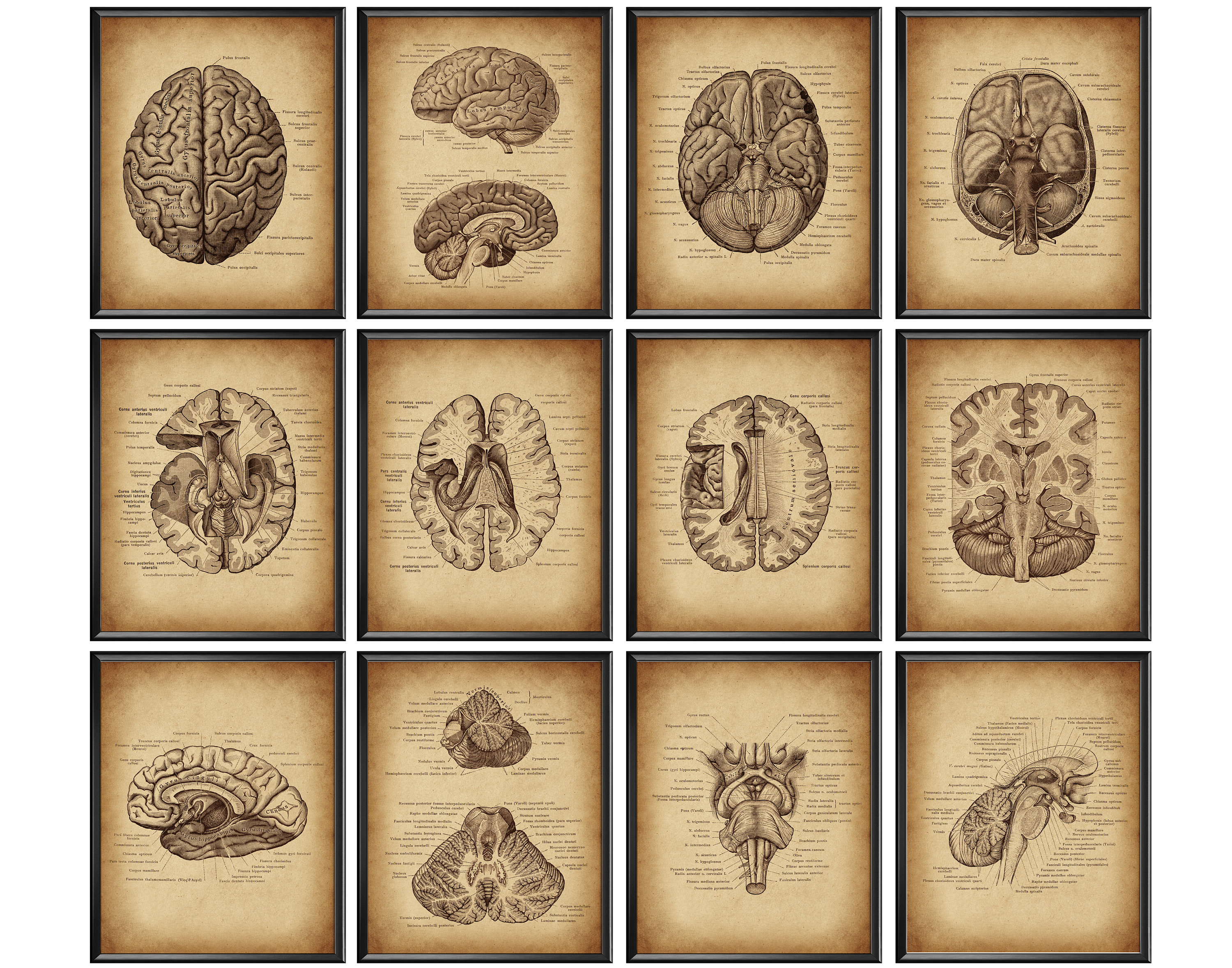 Vintage Brain Anatomy Poster Set 12 Anatomical Artwork Neurology Art ...