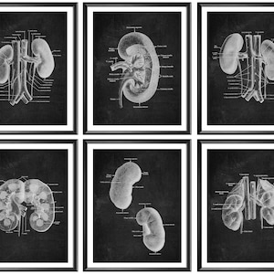 Kidney Anatomy Poster Set 6, Anatomy Art, Nephrology Art, Physiology Art, Chalk Board Art, Urinary System, Nephrologist Office Decor