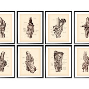8 Knee Surgery Posters Vintage Anatomy Art Knee Join Poster Orthopedic Gift Medical Art Clinic Decor Doctor Gift