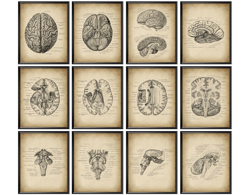 12 Medical Neurology Posters, Vintage Neuroscience Art, Human Brain ...
