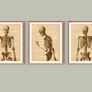 3 Anatomy Art, Orthopedic Art, Chiropractor Gift, Human Skeleton Art, Medical Artwork, Old Dictionary, Orthopedic Surgeon Office Gift