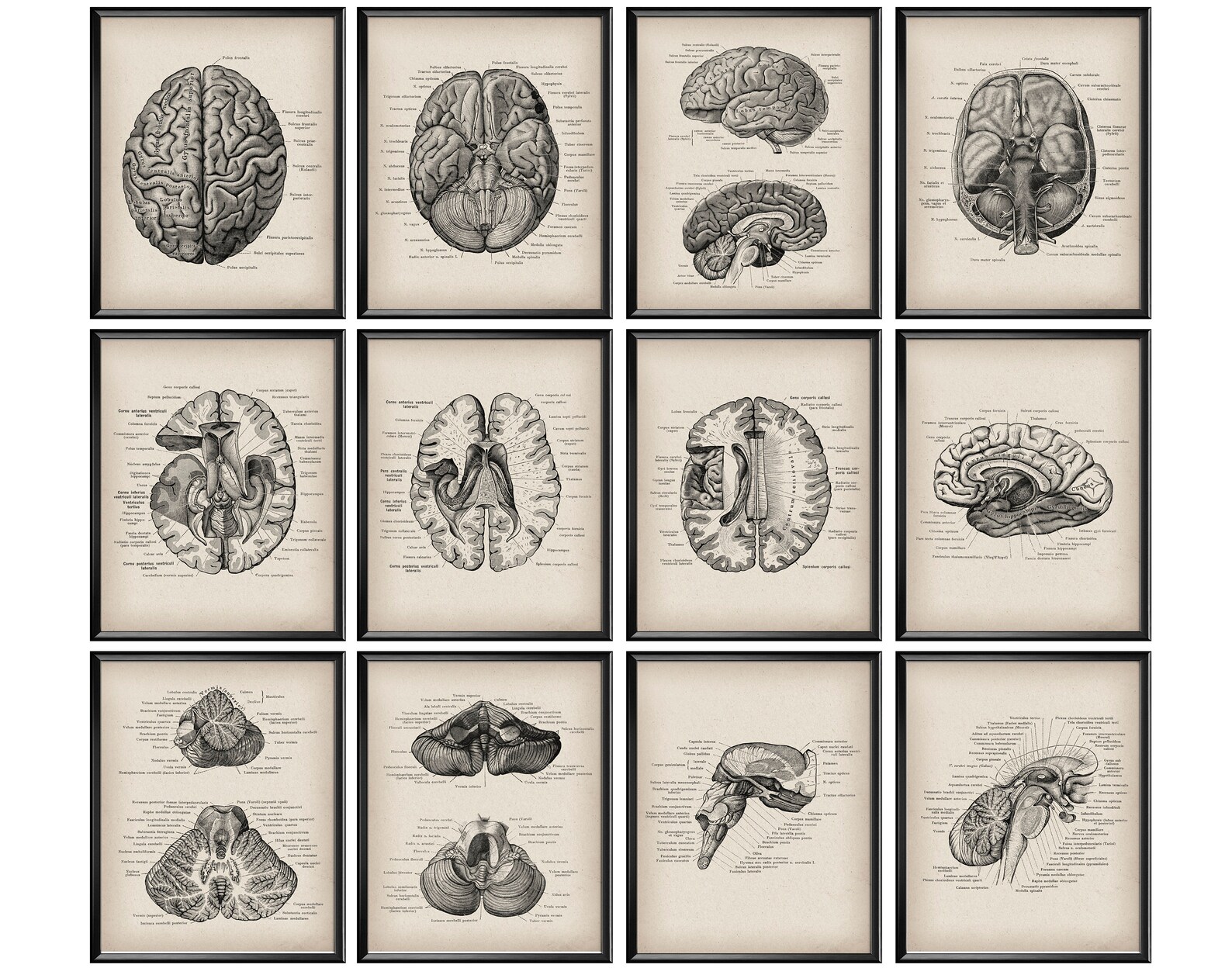 12 Brain Anatomy Poster Vintage Anatomy Art Neurology Art Medical ...