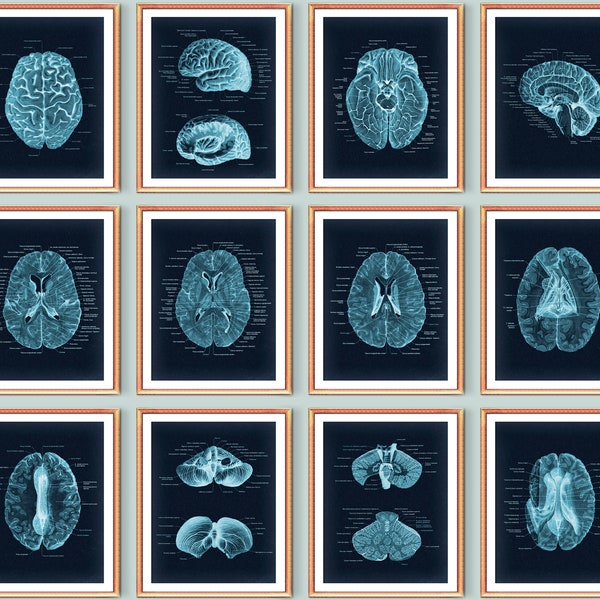 12 Neuroanatomy Art, Neurology Poster, Anatomical Brain Diagram, MRI Brain Scan Art, Neuroscience Art, Neurologist Office Gift, Medical Gift
