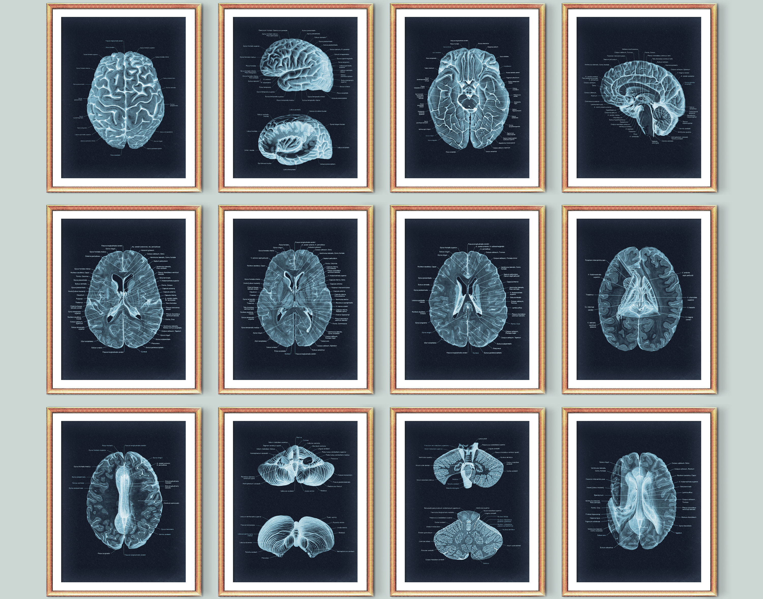 12 Neuroanatomy Art, Neurology Poster, Anatomical Brain Diagram, MRI ...