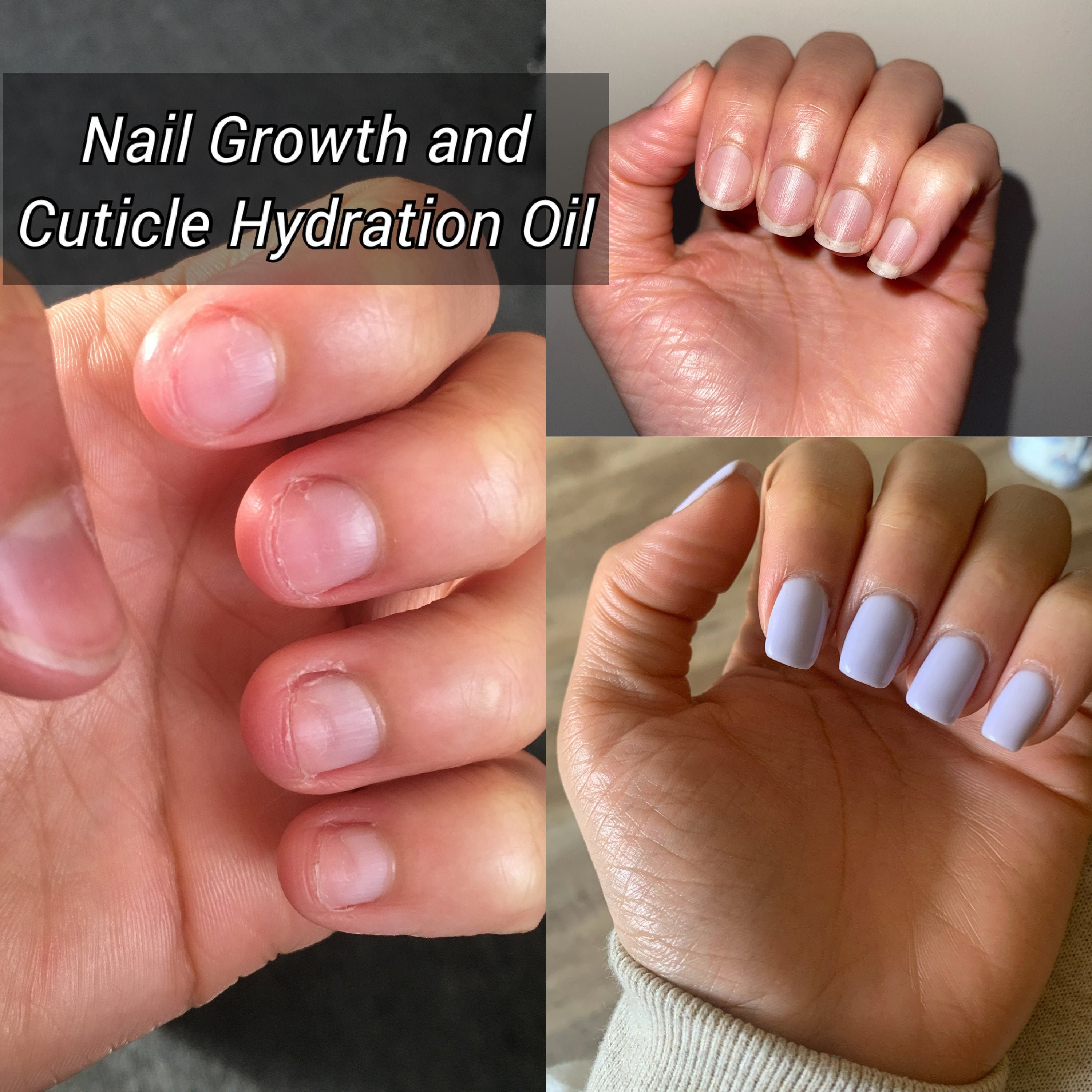 Nail & Cuticle Oil Nail Growth Serum Hydrates Dry Nails Etsy