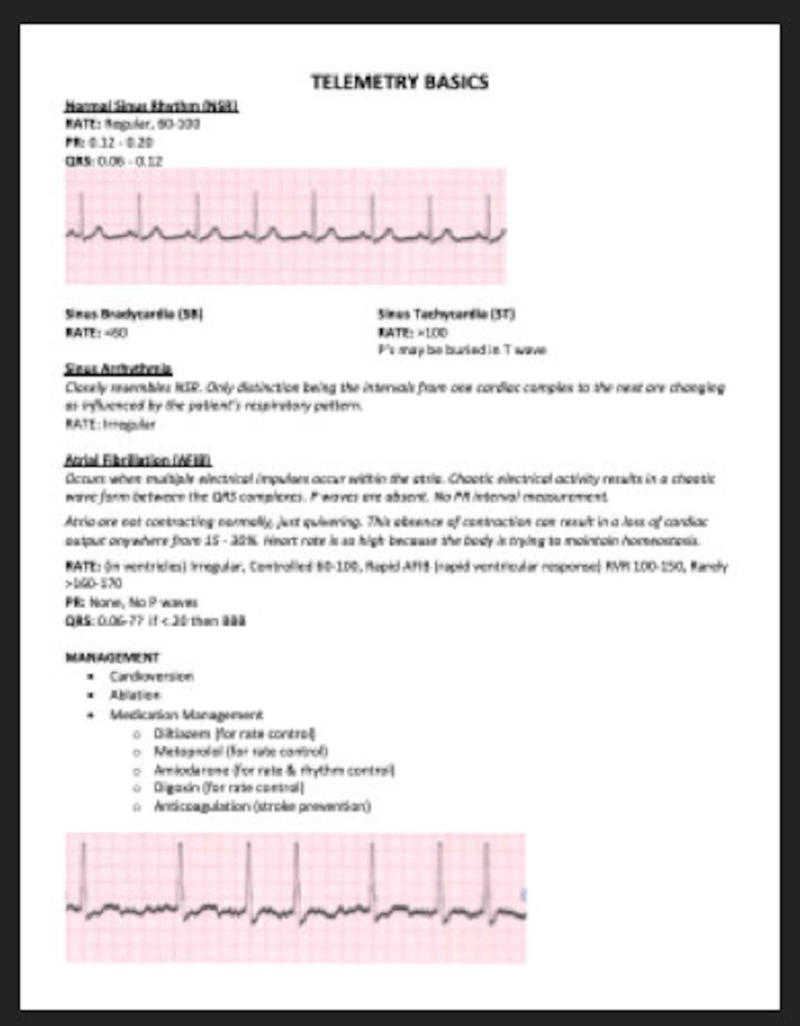 EKG Telemetry Basics (digital Download) | How to Interpret ECG EKG ...