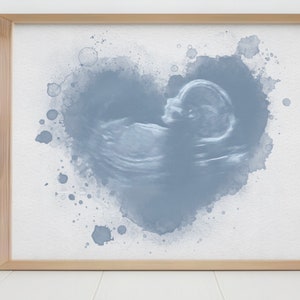 Baby Scan Ink Baby Scan Gift, Watercolour Baby Scan, Pregnancy Announcement, Ultra ...