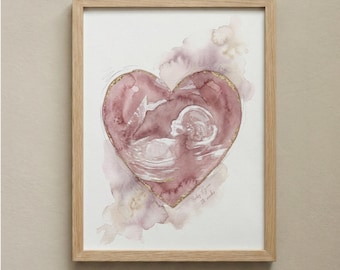 Custom Baby Scan Art | Watercolour Ultrasound Print from Your Scan | Pregnancy Gift | Baby Shower Present | New Baby Keepsake