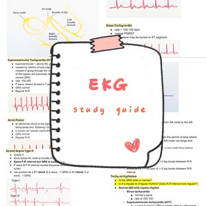 EKG Study Guide, Cardiac Nursing, Fundamentals nursing, Nursing reference, Nursing clinicals, Nclex study, Nursing cheat sheets