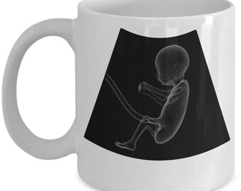 Fathers Day Ultrasound Mug, Fathers Day Ultrasound Cup, Expecting Dad, Fathers Day Ideas, Fathers Day Items, Pregnancy, 3