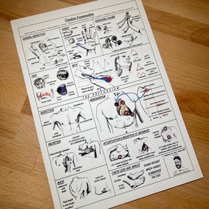 Könnte beinhalten: Ein schwarz-weiß illustrierter Leitfaden zur Durchführung einer Herzuntersuchung. Der Leitfaden enthält Illustrationen des Körpers, der Hände und des Herzens sowie Text, der die Schritte der Untersuchung beschreibt. Der Text enthält Begriffe wie "Allgemeine Inspektion", "Inspektion", "Palpation", "Rücken", "Hals", "Die Präkordial-Auskultation", "Akzentuierung und Ausstrahlung von Herzgeräuschen", "Beine und Knöchel kontrollieren" und "Patienten danken, Hände waschen, zusammenfassen, das Ende".