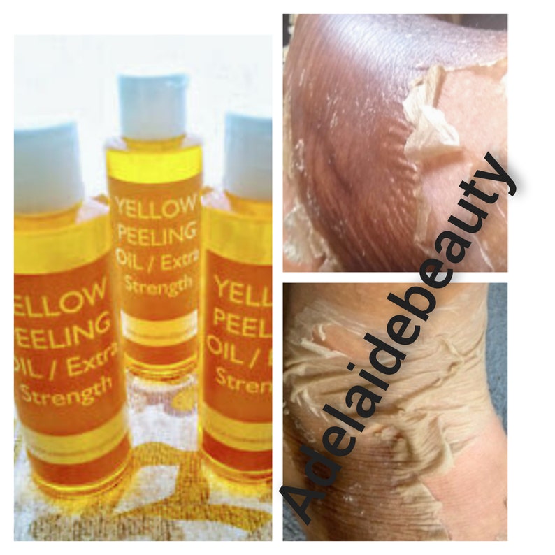 YELLOW PEELING OIL Extra Strength Etsy
