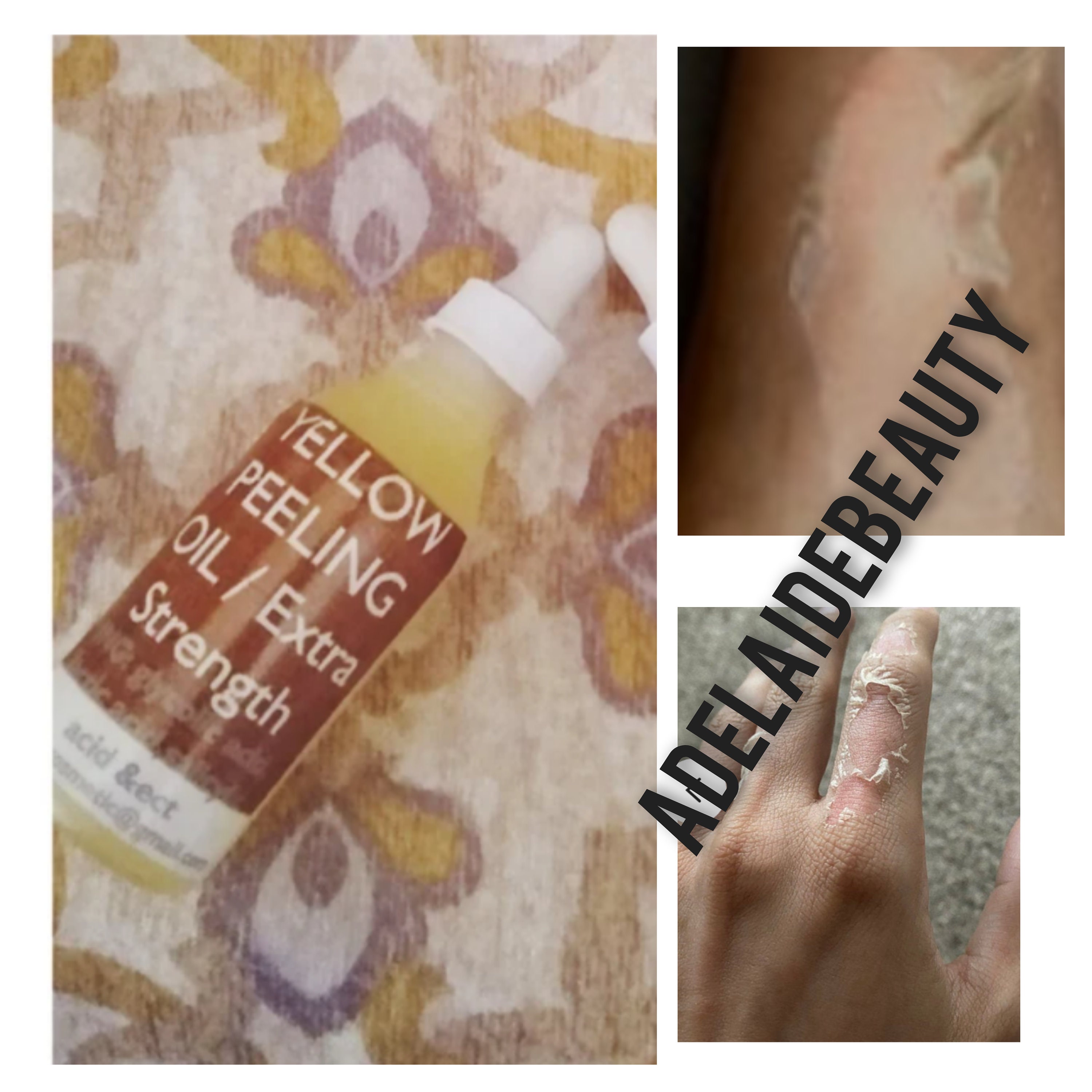 Skin peeling oil -  France