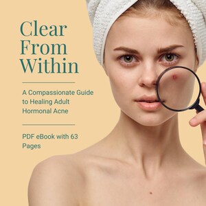 May include: A woman with a white towel on her head holds a magnifying glass near her face, focusing on a blemish. The image includes text that reads "Clear From Within" and "A Compassionate Guide to Healing Adult Hormonal Acne. PDF eBook with 63 Pages."