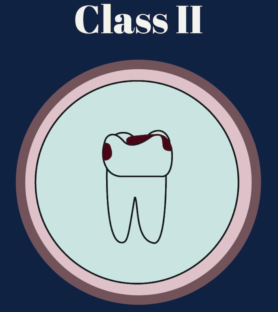 Tooth Numbering System Diagram Svg Png Jpeg Ai Pdf Dental Dentistry Jaw ...