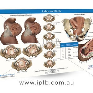 Chart 10 - Labor & Birth