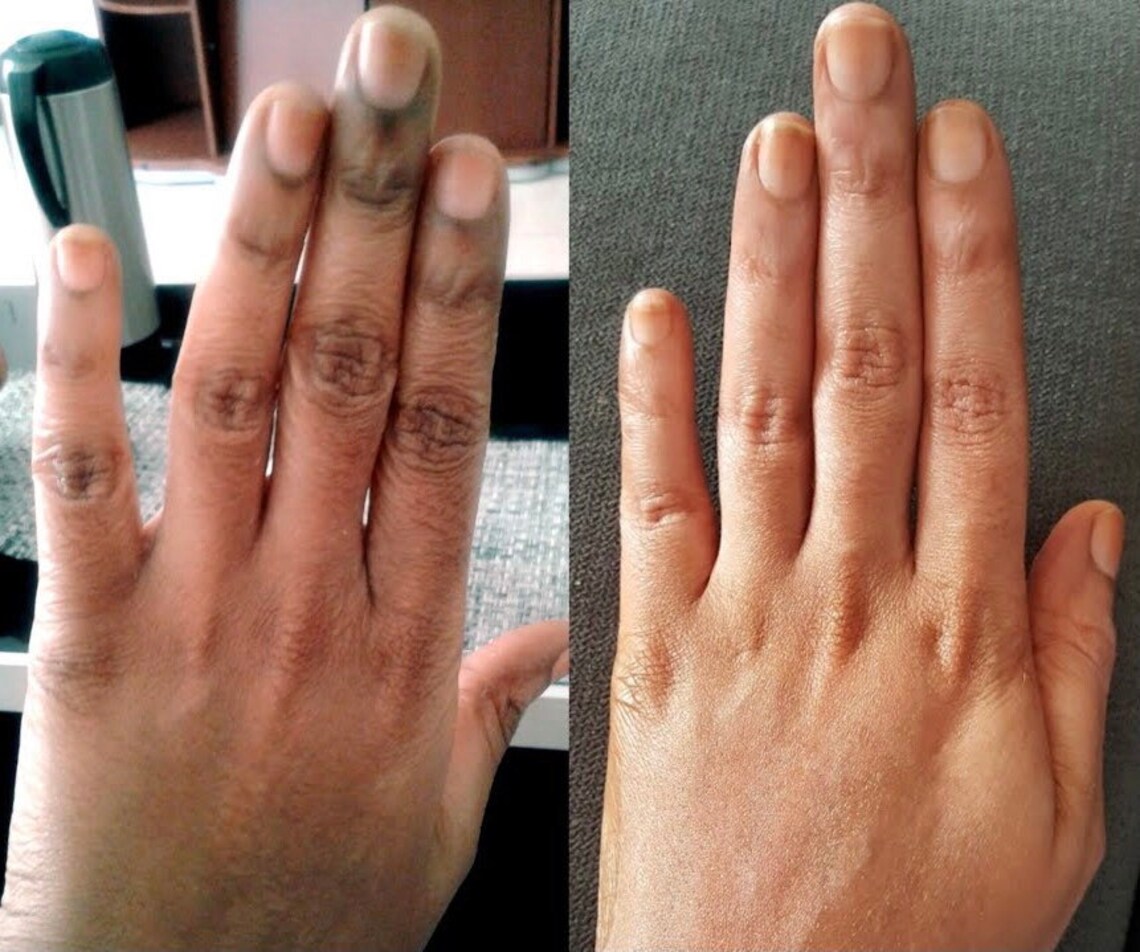 Dark Knuckles exfoliating and bleaching Semi permanent highly Etsy